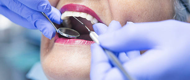 Best Emergency Dental Care for Abscessed Tooth in Helena, AL